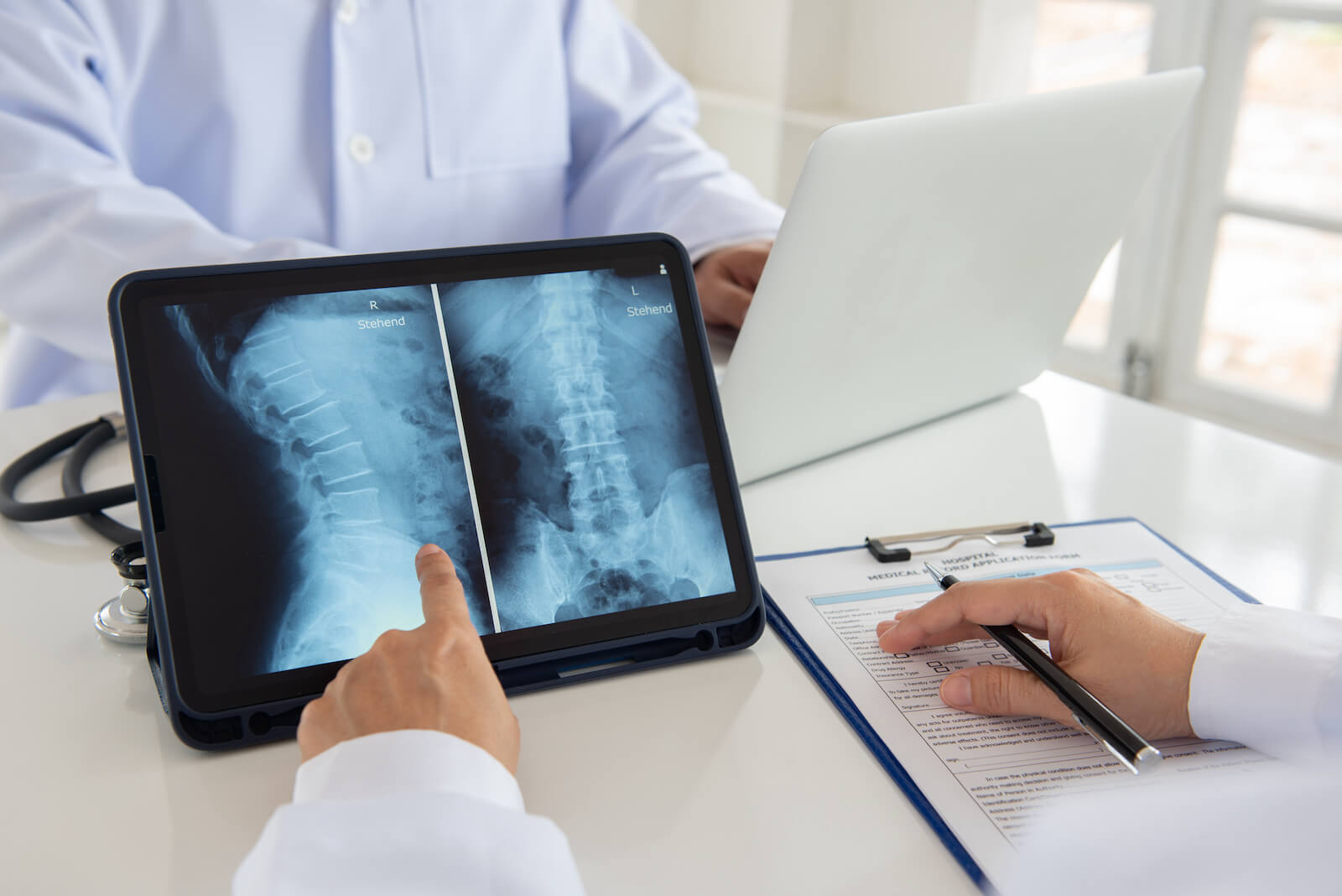 A gerinc röntgen vizsgálat remekül alkalmasak a mozgásszervi problémák feltérképezésére.