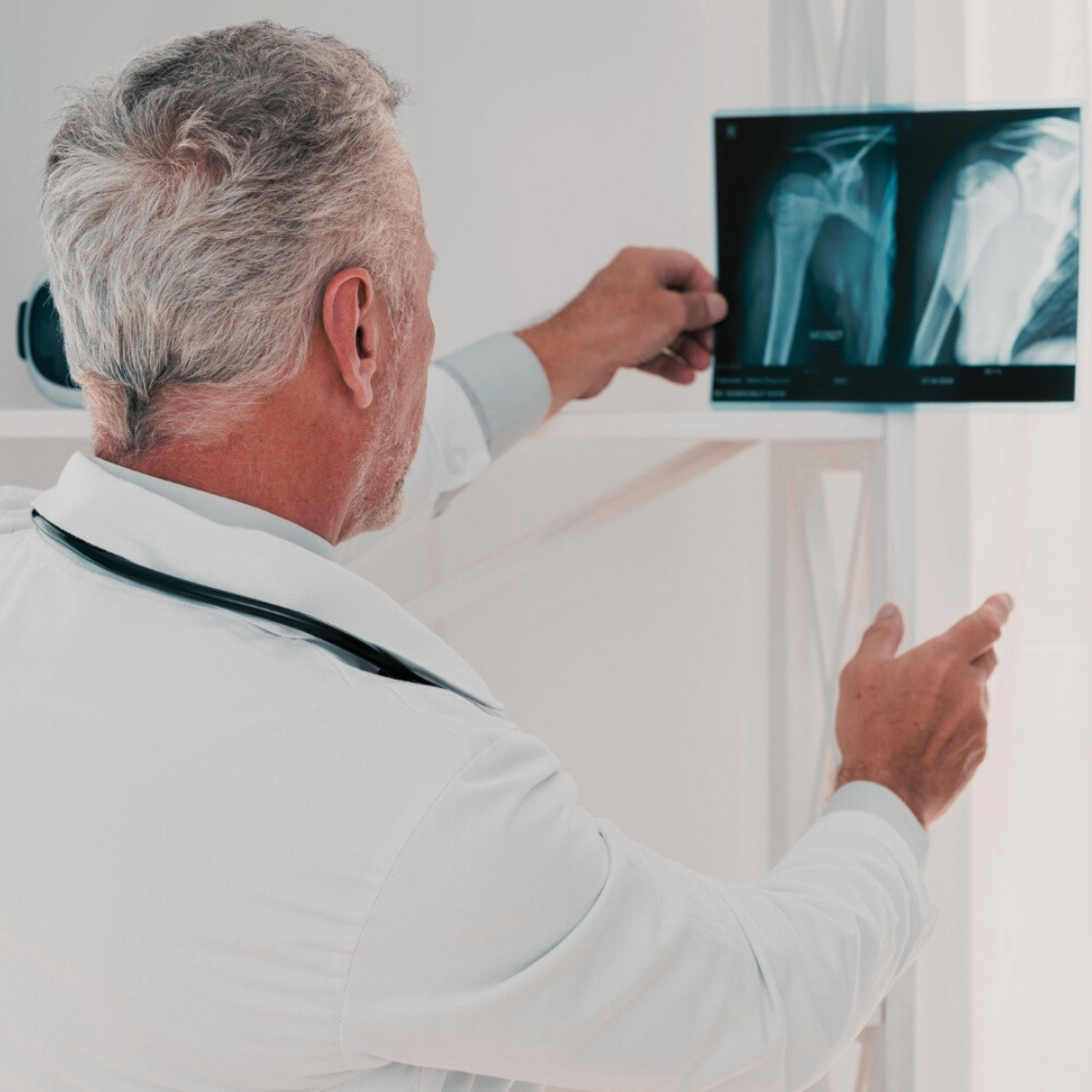 A válltörés rögzítése előtte röntgen készül.