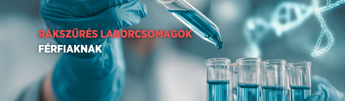 Rákszűrés laborcsomagok férfiaknak