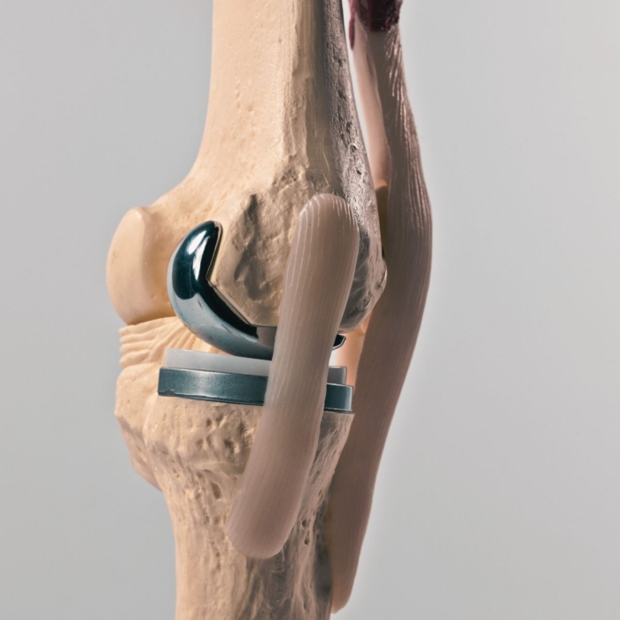 Megoldási lehetőségek korábban és napjainkban