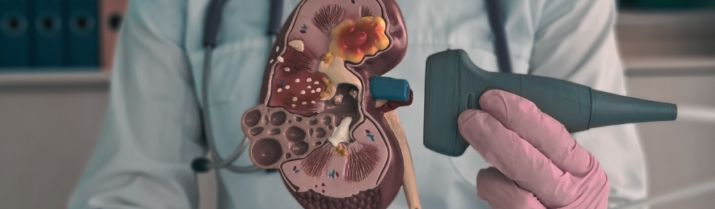 thulium-lezer-veseko-kokozpont