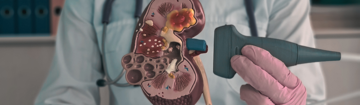 thulium-lezer-veseko-kokozpont