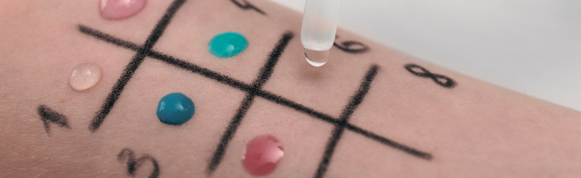 Kedvezményes allergológiai vizsgálatok