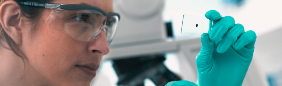 myGeneticRisk - Gyakori betegségek genetikai kockázatbecslése